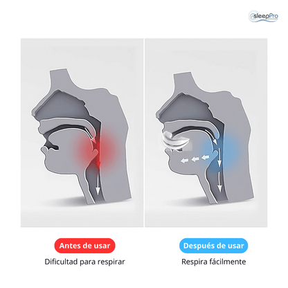 Guarda Antirronquidos SleepPro  - 3 a 6 MSI con PayPal