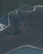 SleepPro – Guarda Bucal Anti-Ronquidos / 3 MSI