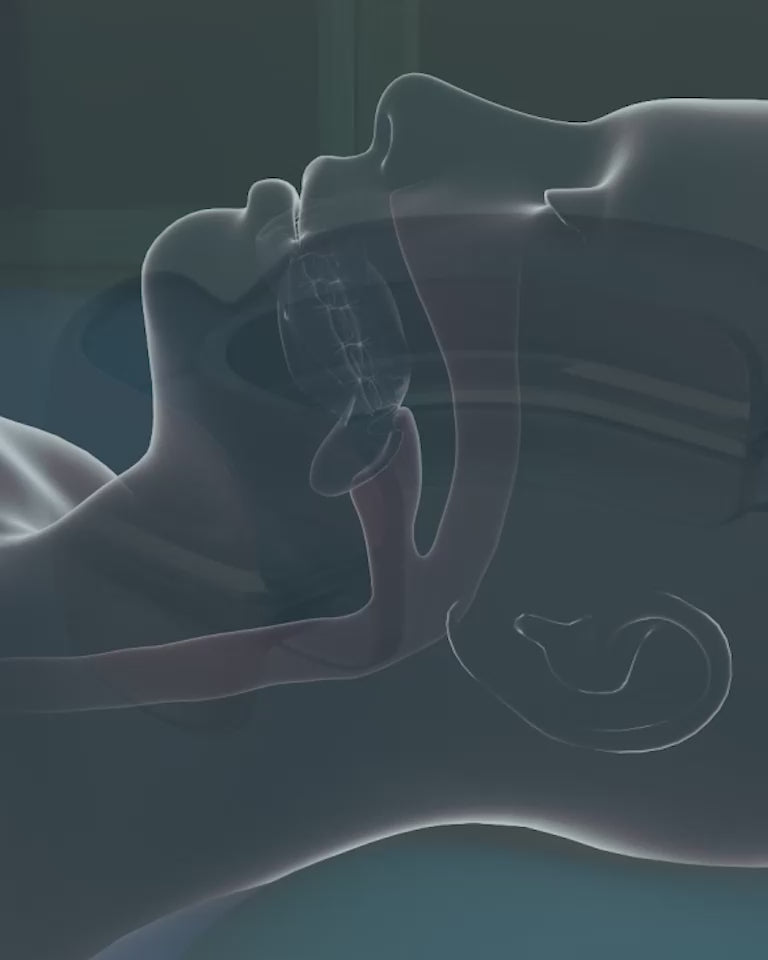 SleepPro – Guarda Bucal Anti-Ronquidos / 3 MSI